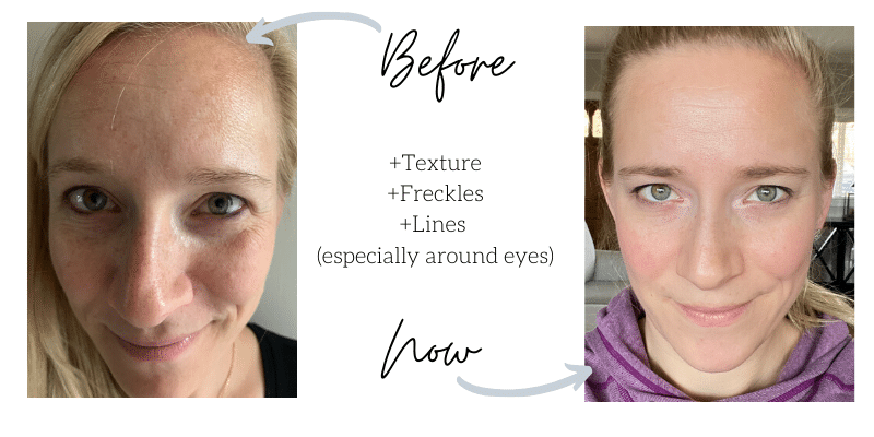 before and after photos