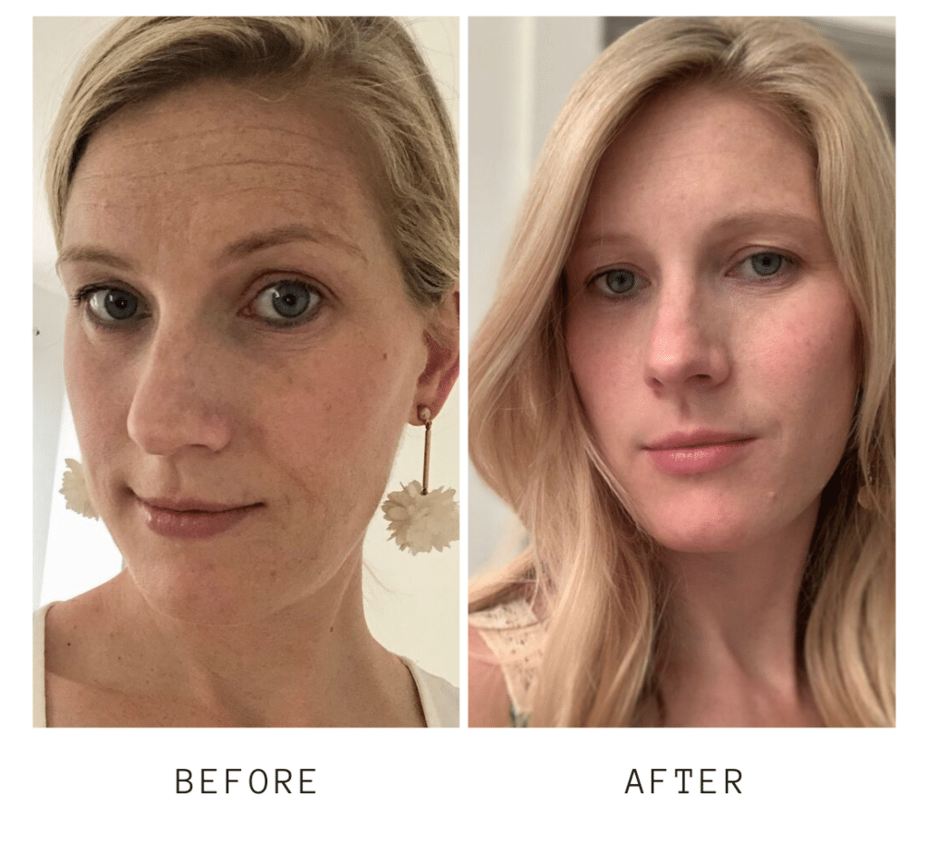sister before and after Beautycounter sister before and after using Beautycounter